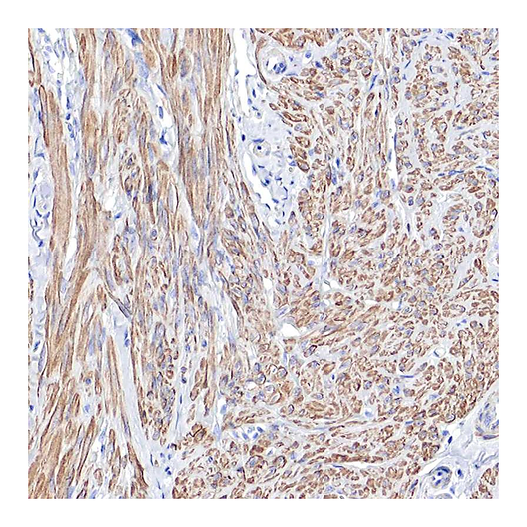 Atlas Antibodies Anti-TPM1 Antibody