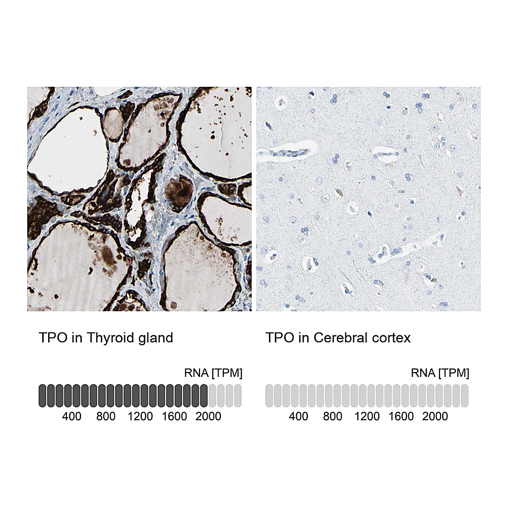 Atlas Antibodies Anti-TPO Antibody