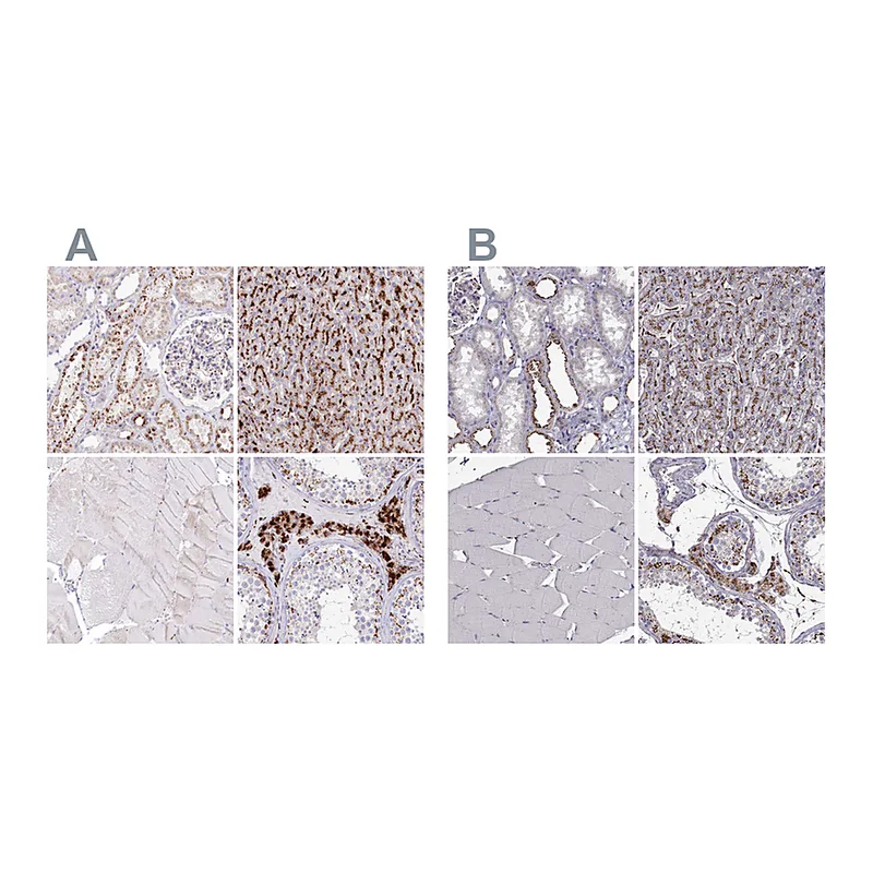 Atlas Antibodies Anti-TPP1 Antibody
