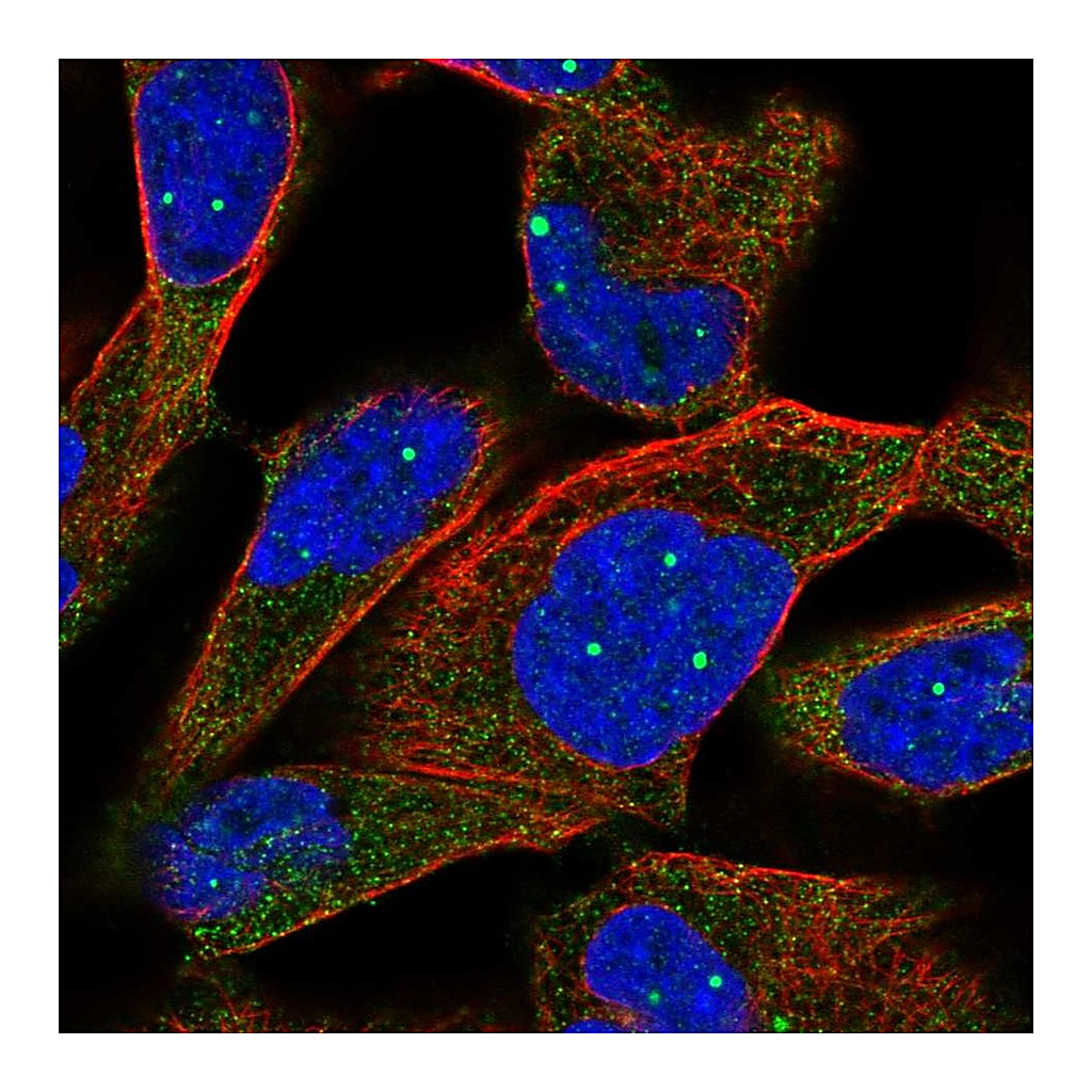 Atlas Antibodies Anti-TPP2 Antibody