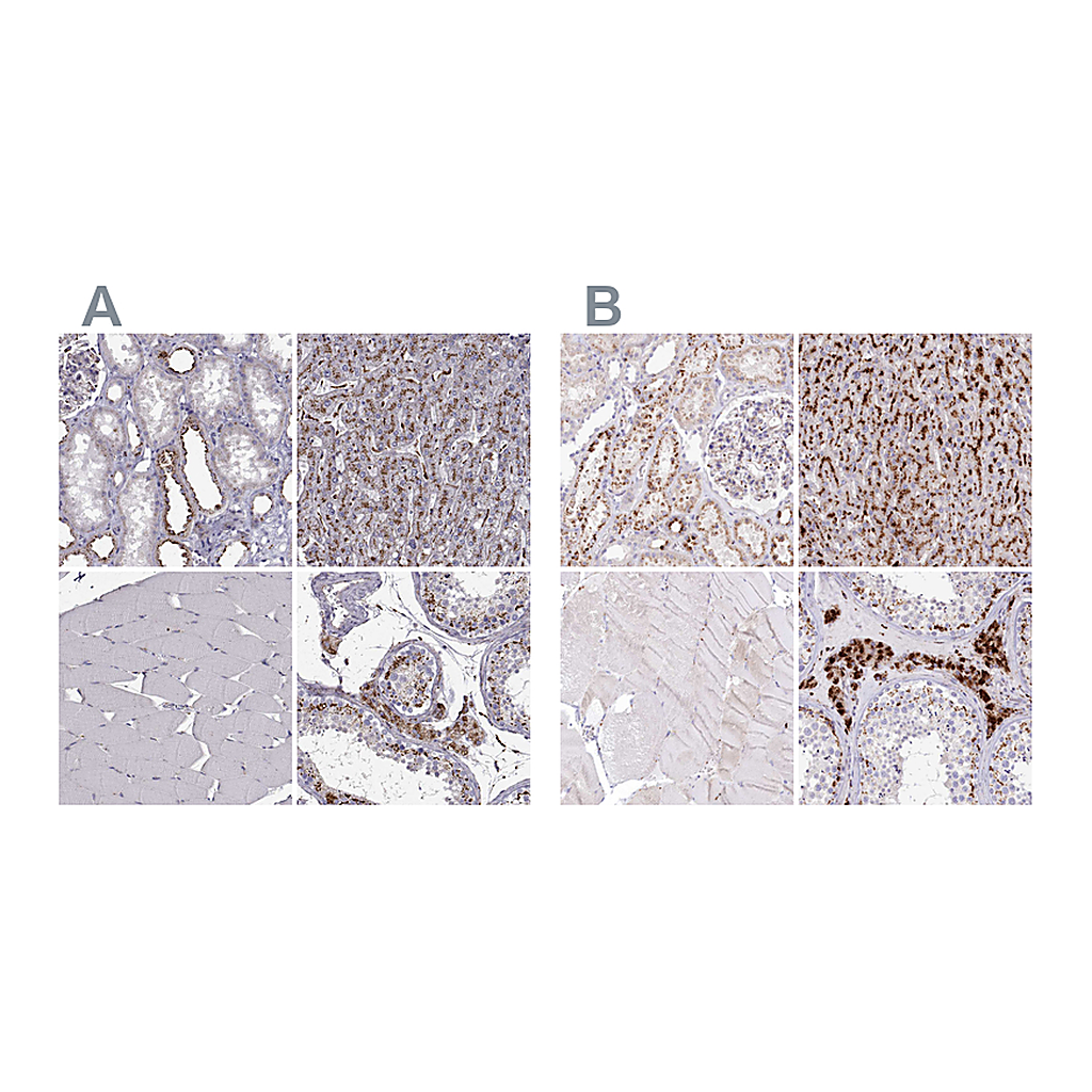 Atlas Antibodies Anti-TPP1 Antibody