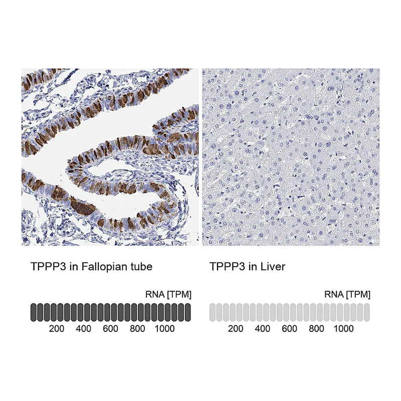 Atlas Antibodies Anti-TPPP3 Antibody