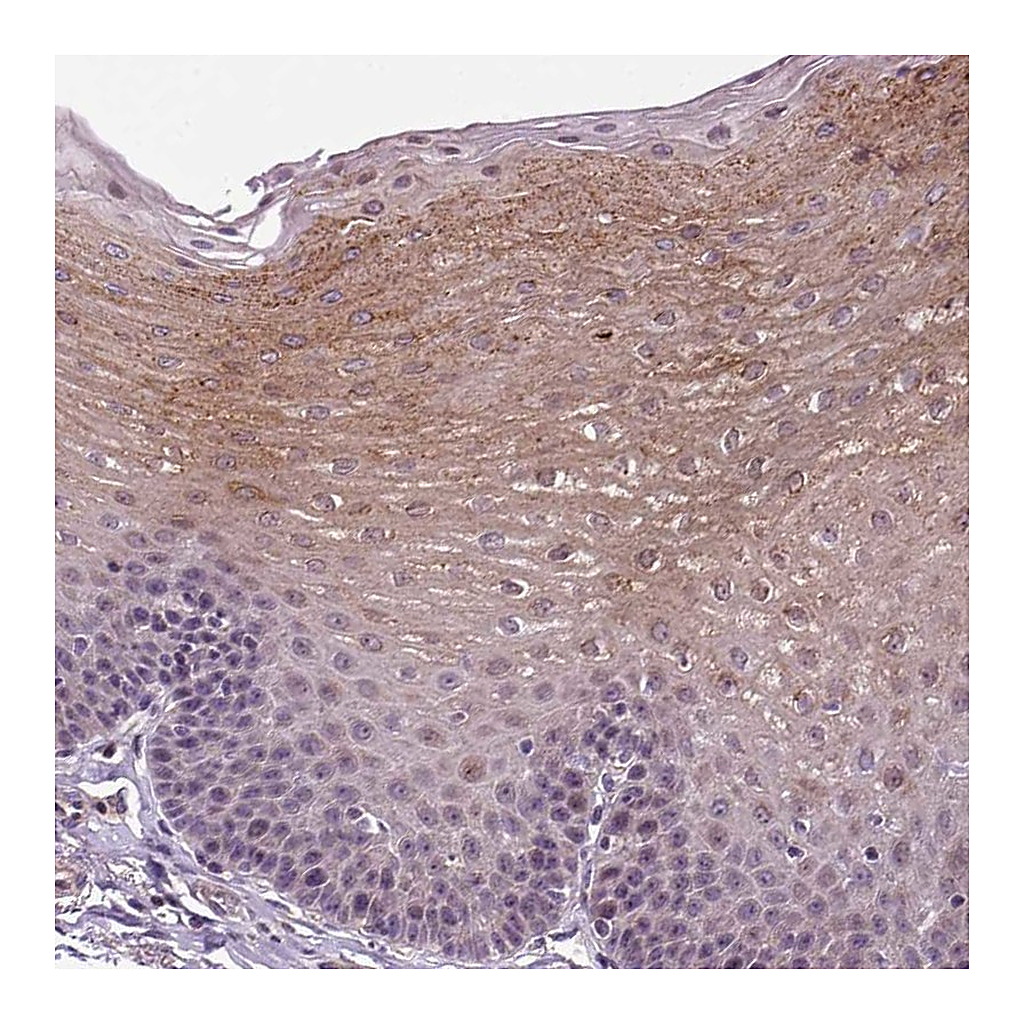 Atlas Antibodies Anti-TPRG1 Antibody