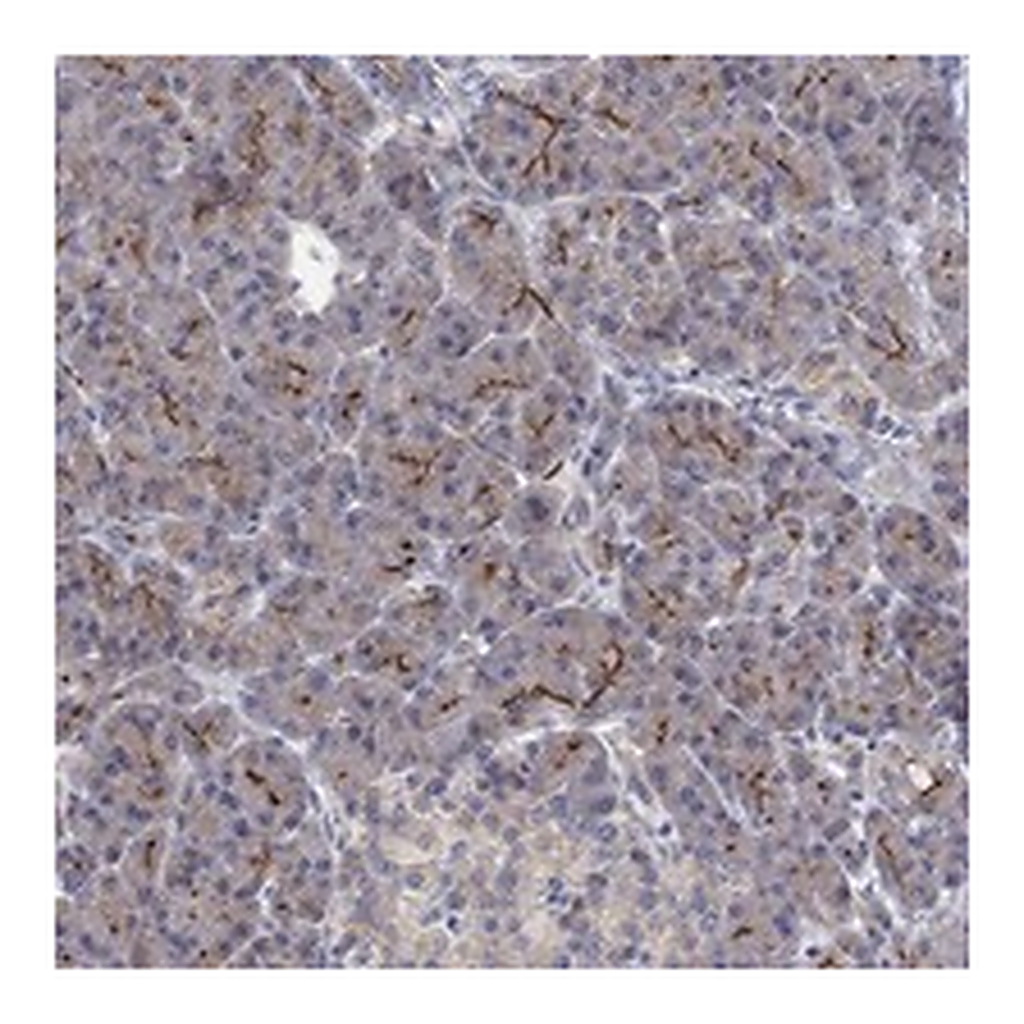 Atlas Antibodies Anti-TPRN Antibody