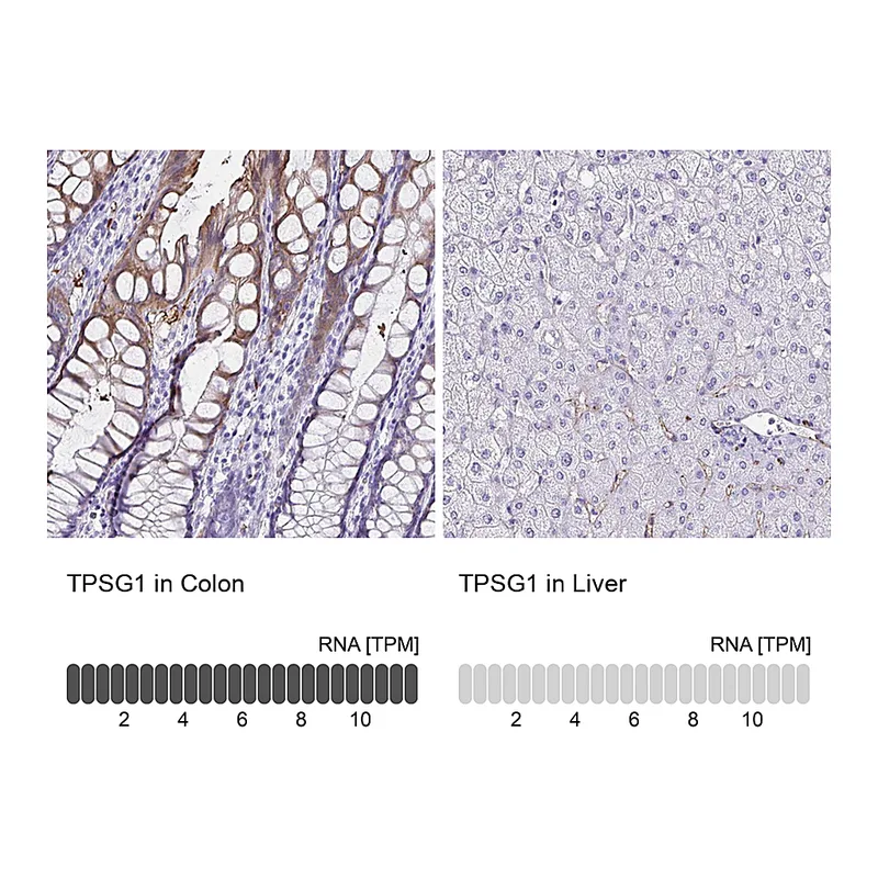 Atlas Antibodies Anti-TPSG1 Antibody