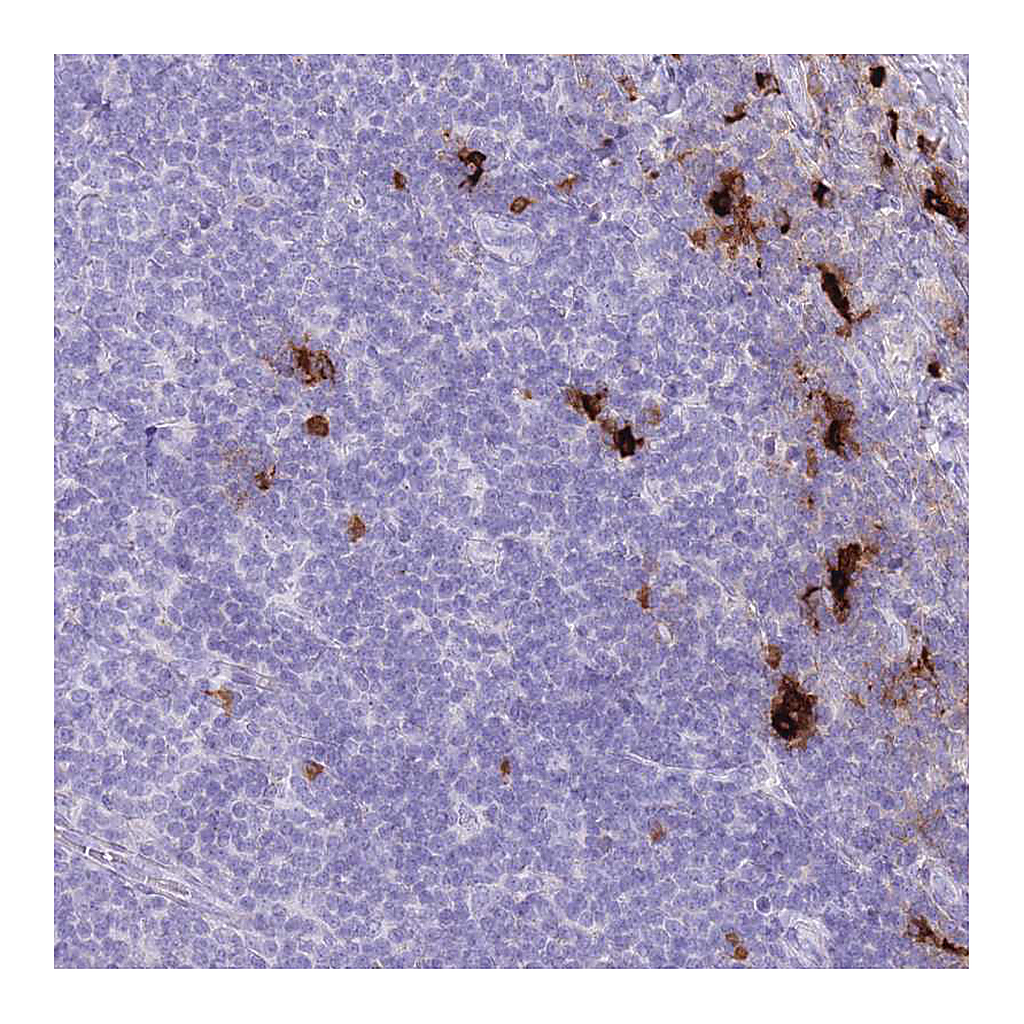 Atlas Antibodies Anti-TPSB2 Antibody