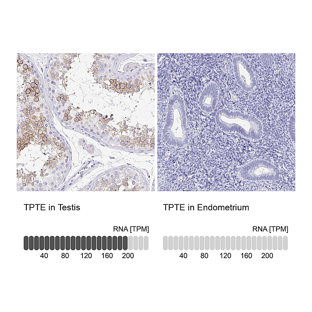 Atlas Antibodies Anti-TPTE Antibody