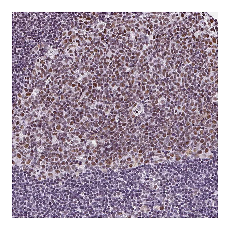 Atlas Antibodies Anti-TRA2B Antibody