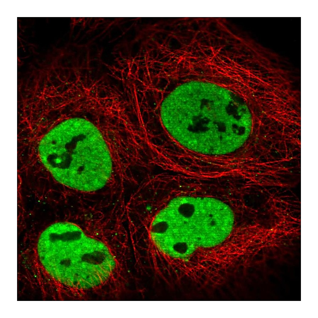 Atlas Antibodies Anti-TRA2B Antibody