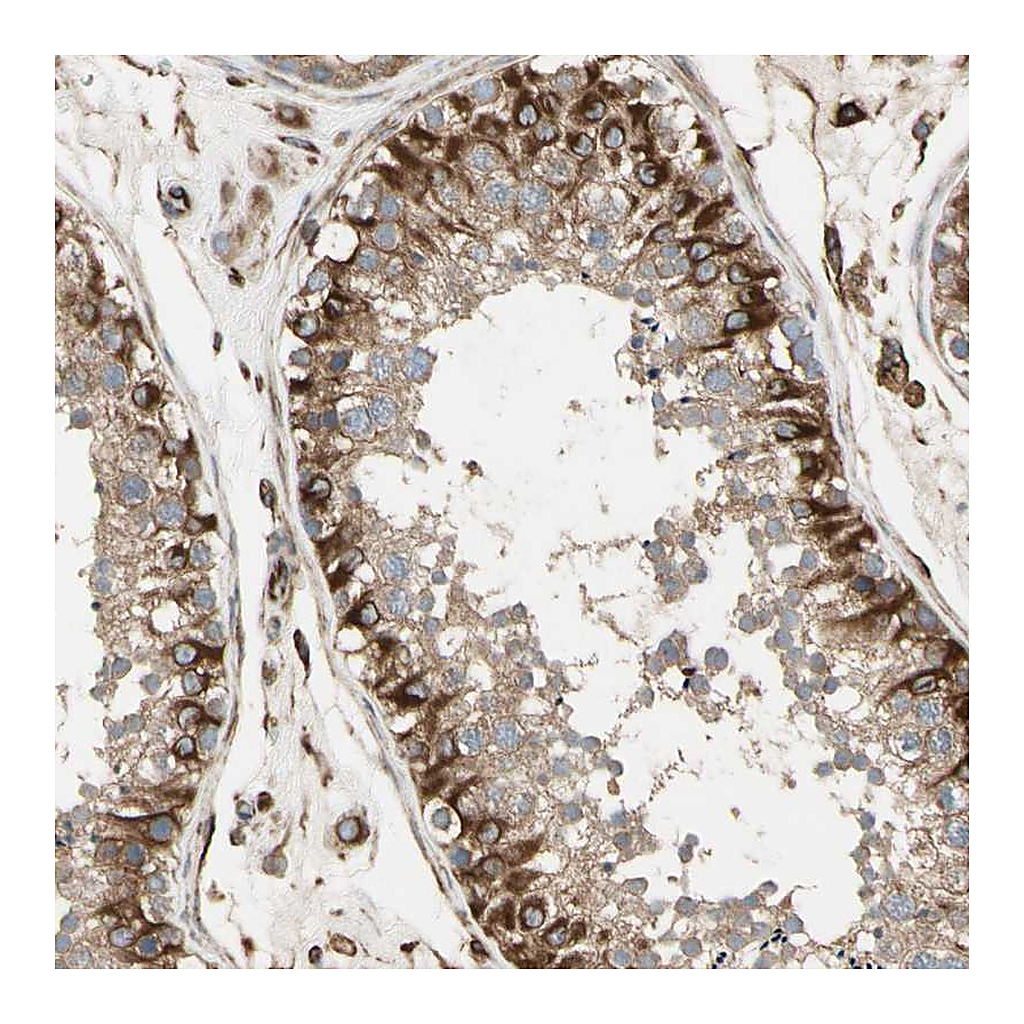 Atlas Antibodies Anti-TRAF2 Antibody