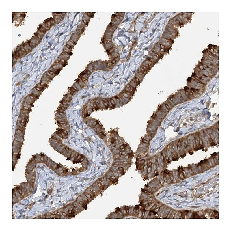 Atlas Antibodies Anti-TRAF3IP1 Antibody