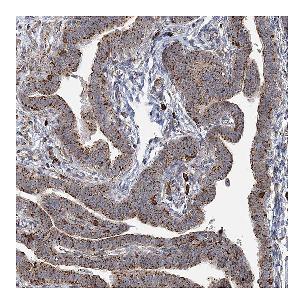 Atlas Antibodies Anti-TRAF3IP2 Antibody