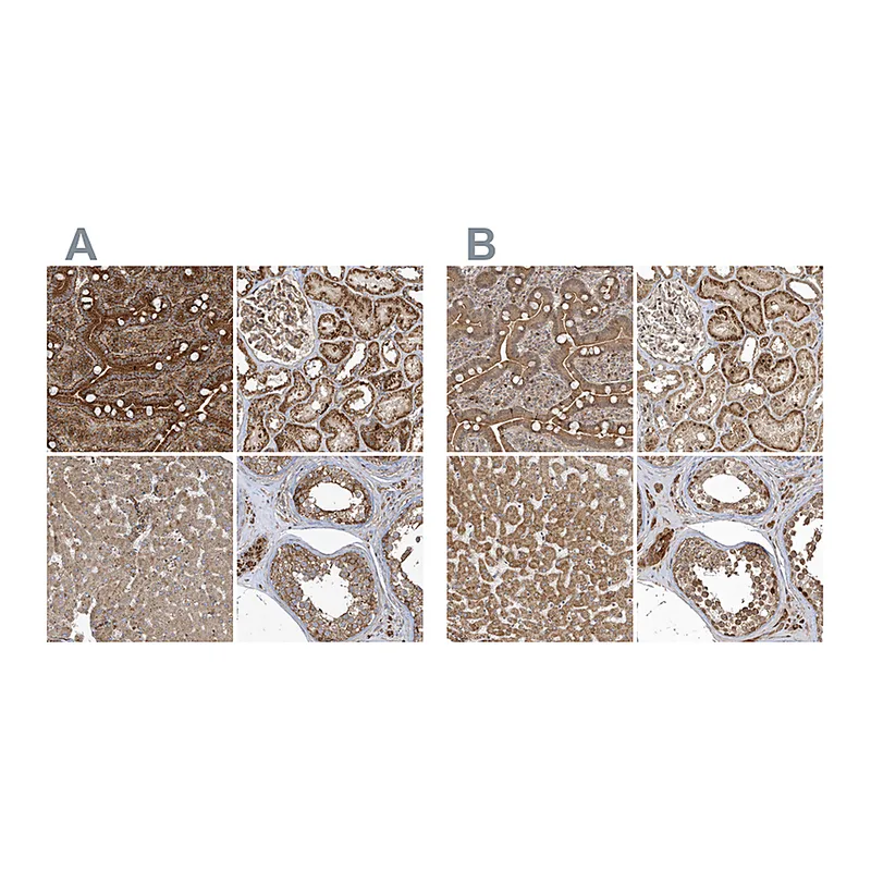 Atlas Antibodies Anti-TRAIP Antibody
