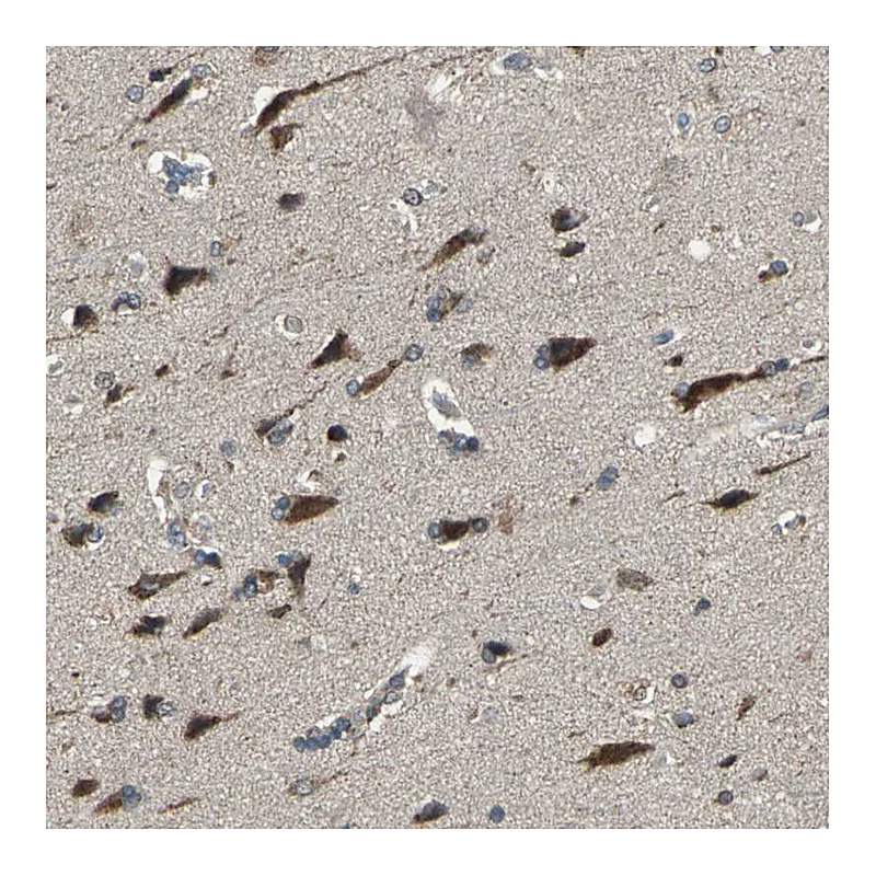 Atlas Antibodies Anti-TRAK1 Antibody