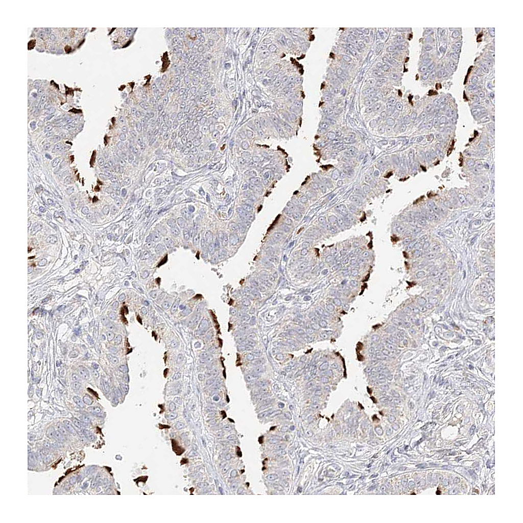 Atlas Antibodies Anti-TRANK1 Antibody