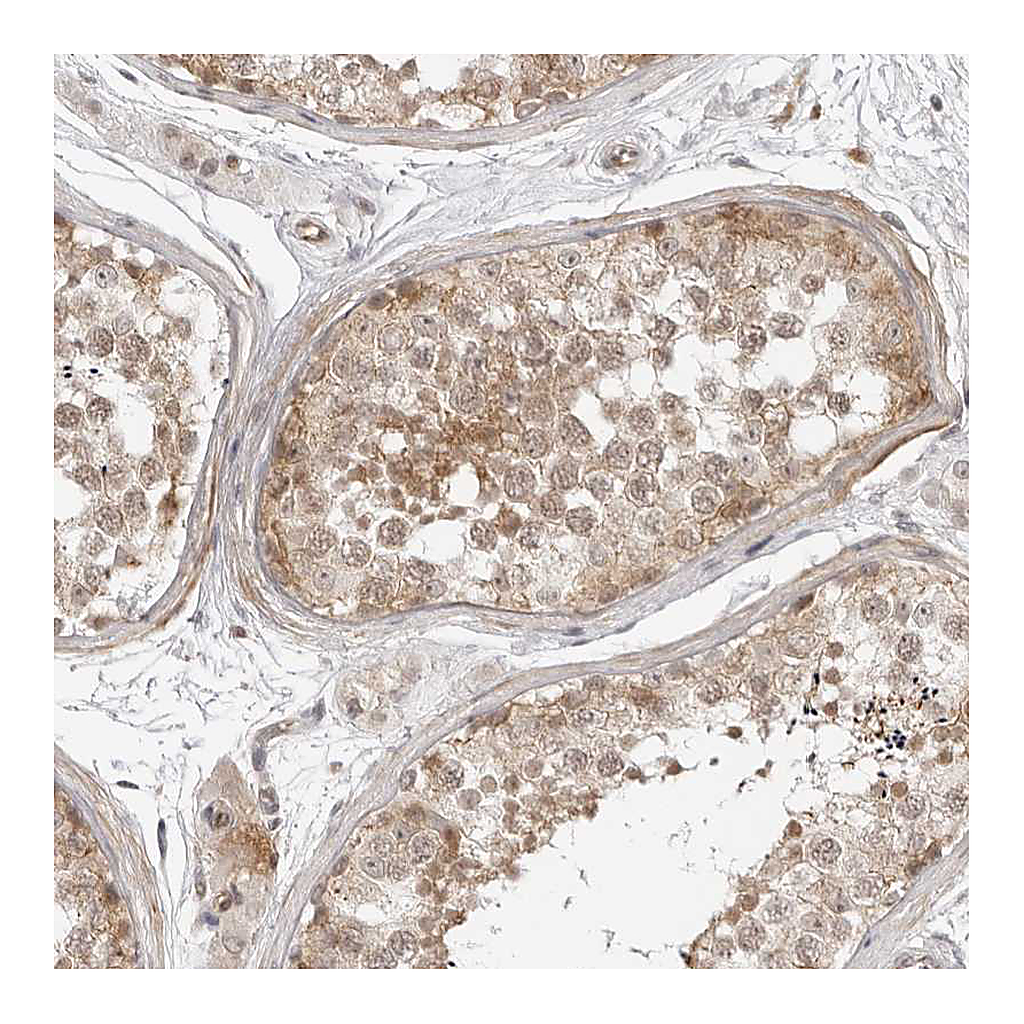 Atlas Antibodies Anti-TRAPPC3 Antibody