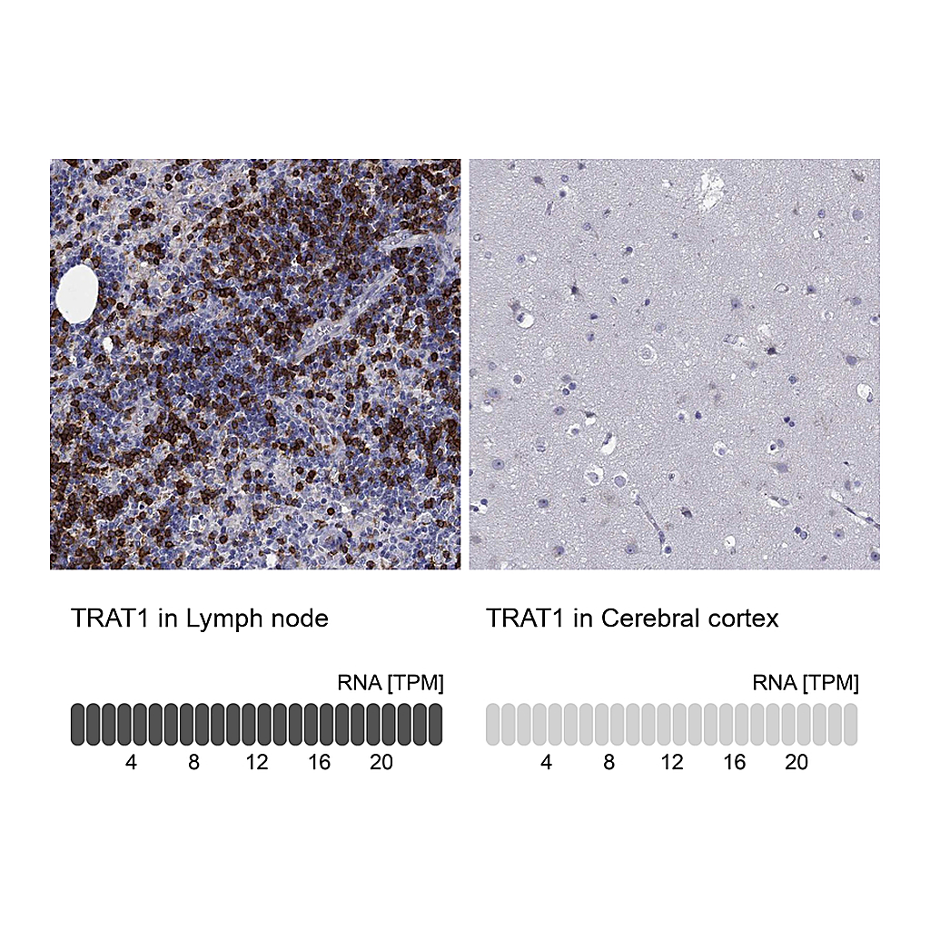Atlas Antibodies Anti-TRAT1 Antibody
