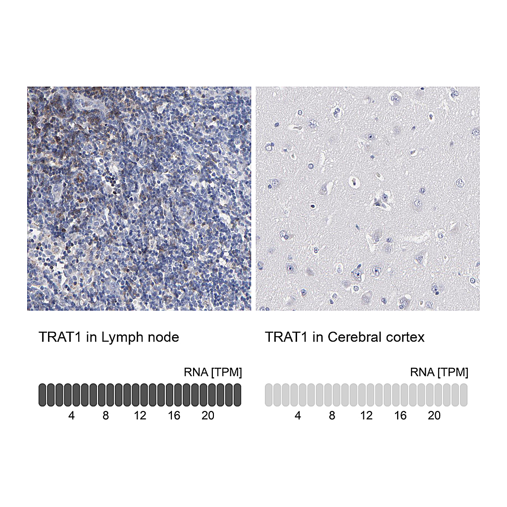 Atlas Antibodies Anti-TRAT1 Antibody