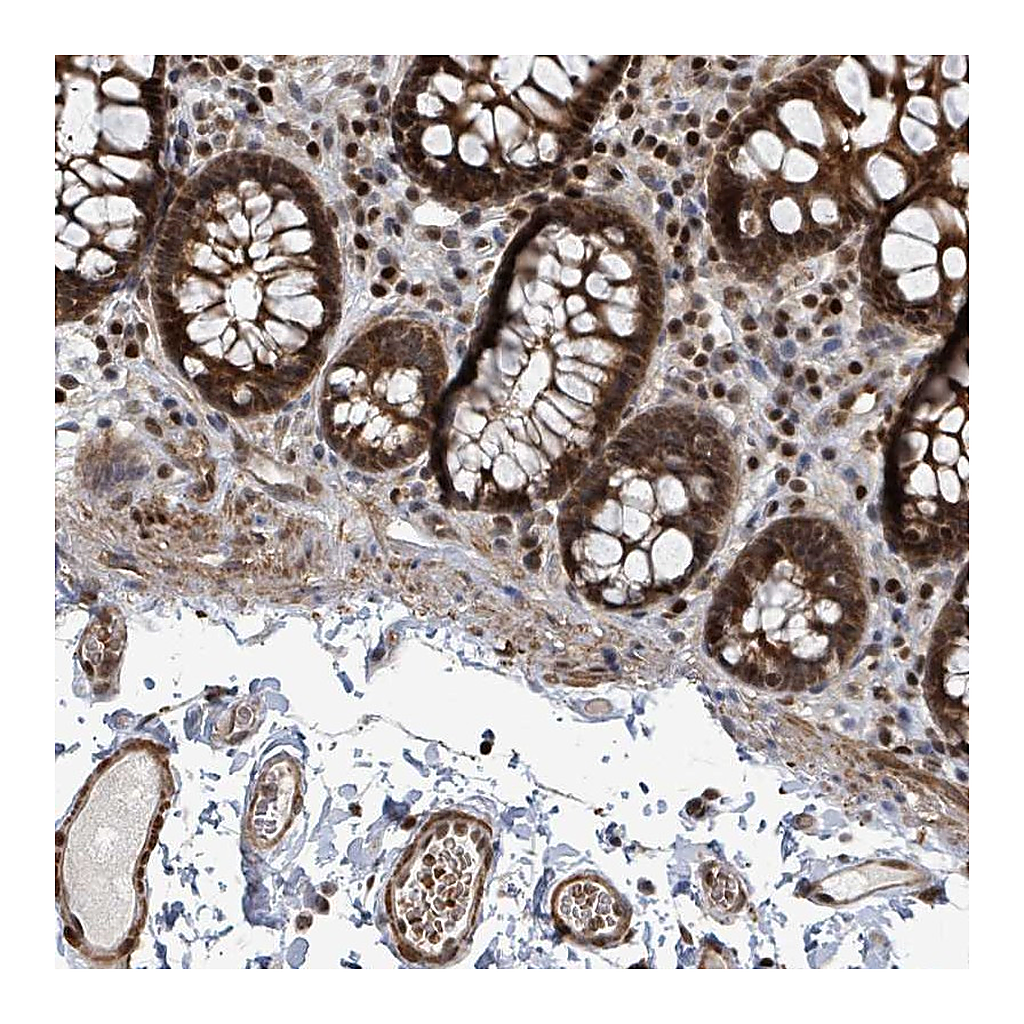 Atlas Antibodies Anti-TRDMT1 Antibody