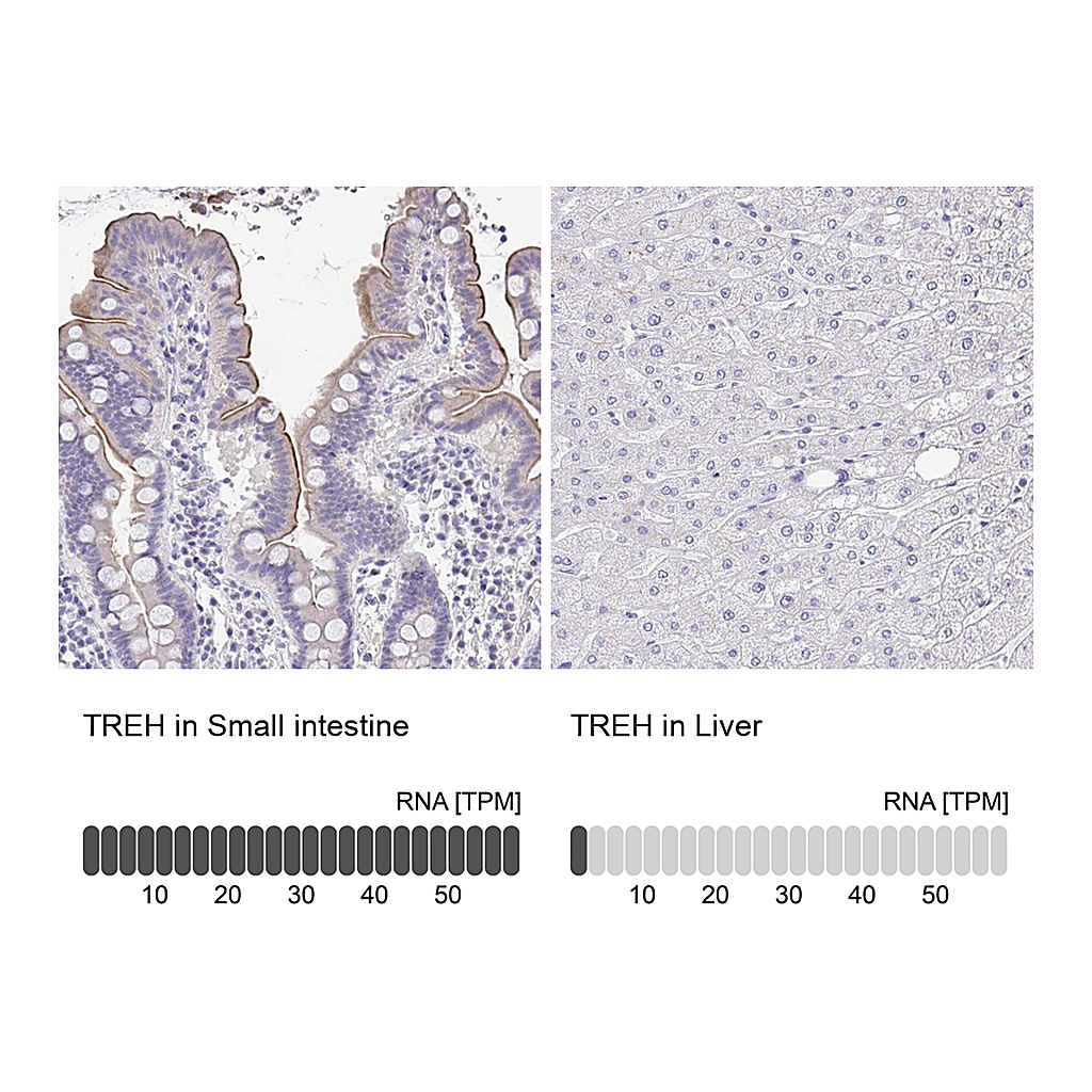 Atlas Antibodies Anti-TREH Antibody