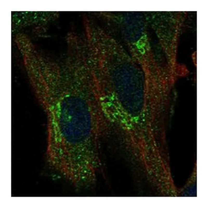 Atlas Antibodies Anti-TREM1 Antibody