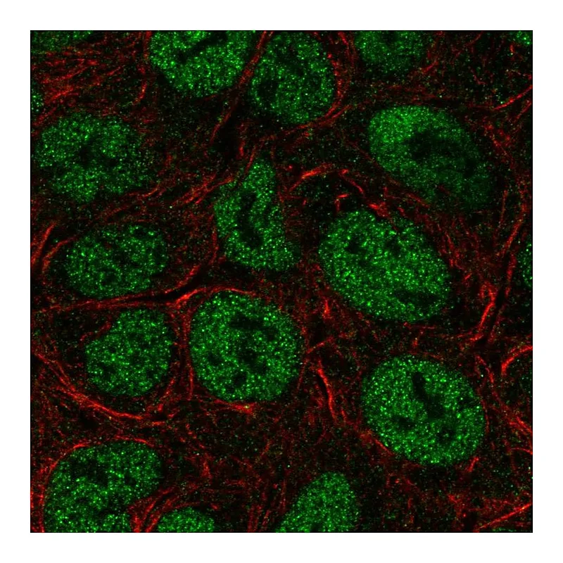 Atlas Antibodies Anti-TRERF1 Antibody