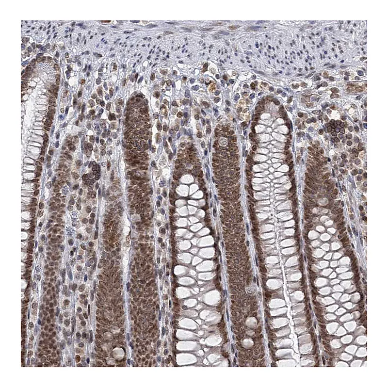 Atlas Antibodies Anti-TREX1 Antibody