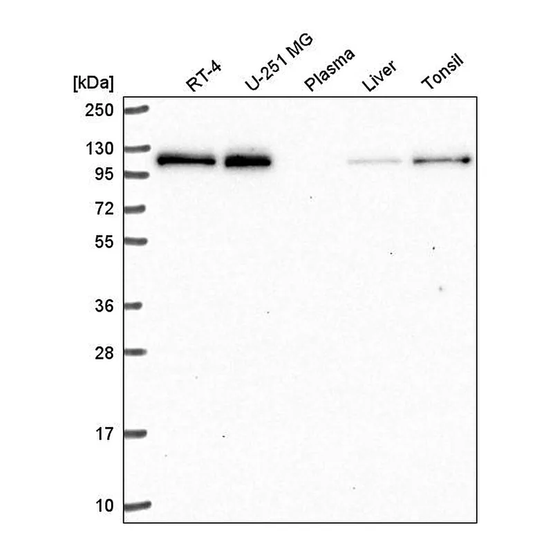 Atlas Antibodies Anti-TRERF1 Antibody