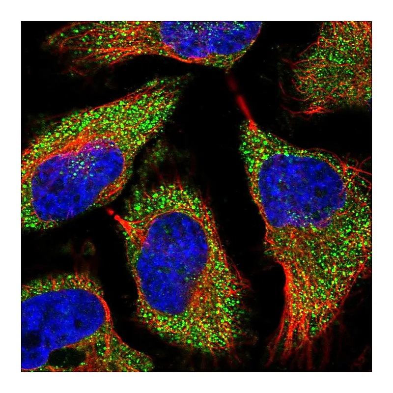 Atlas Antibodies Anti-TREX1 Antibody
