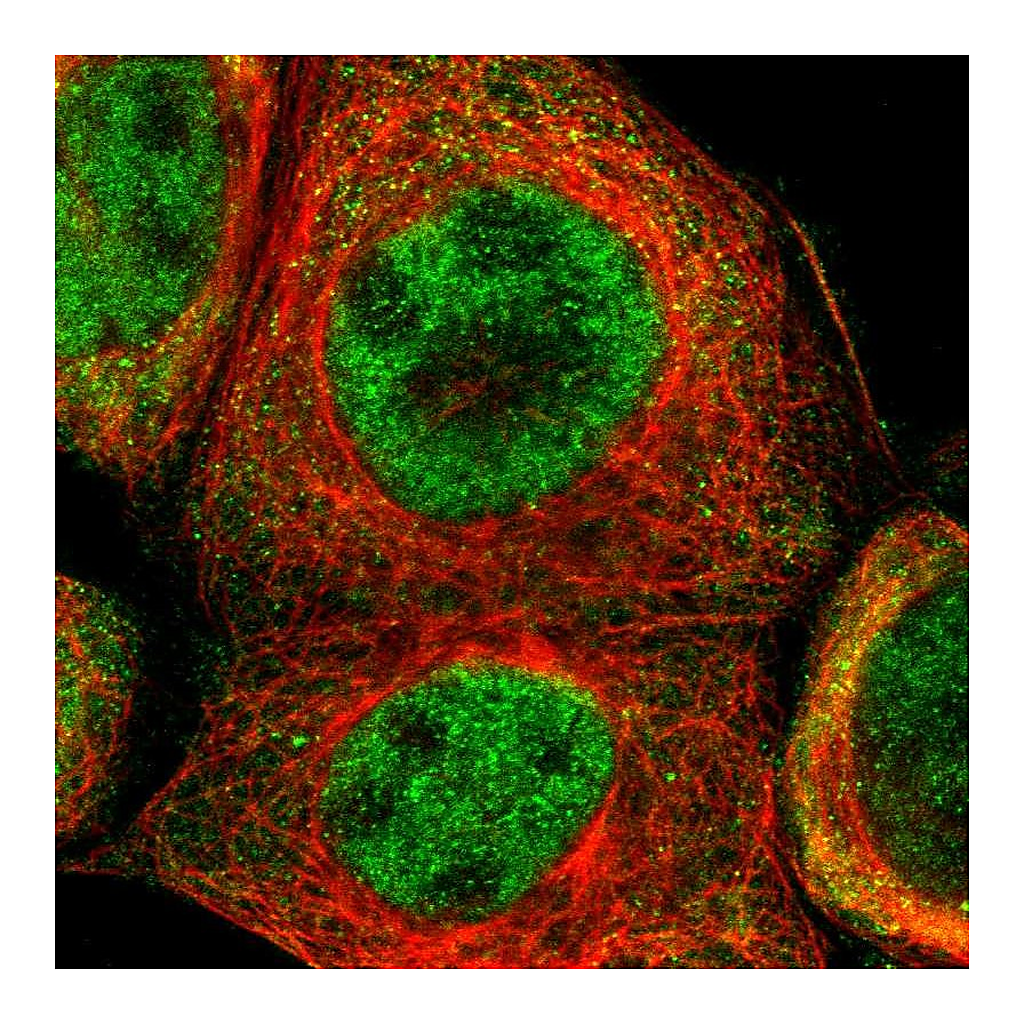 Atlas Antibodies Anti-TRIB2 Antibody