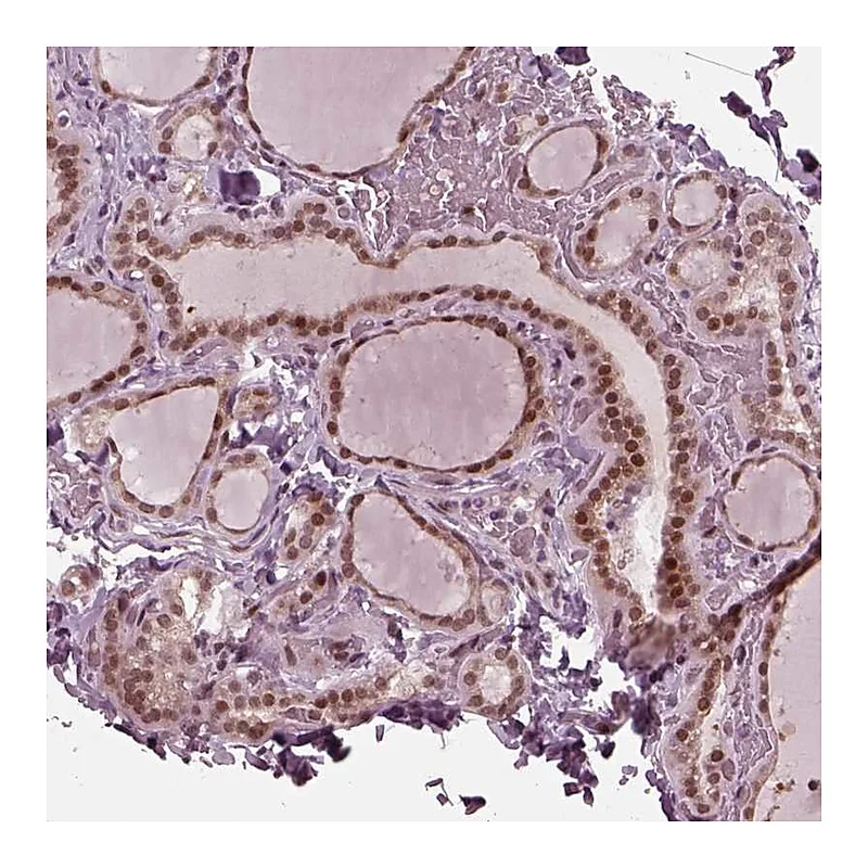 Atlas Antibodies Anti-TRIB3 Antibody