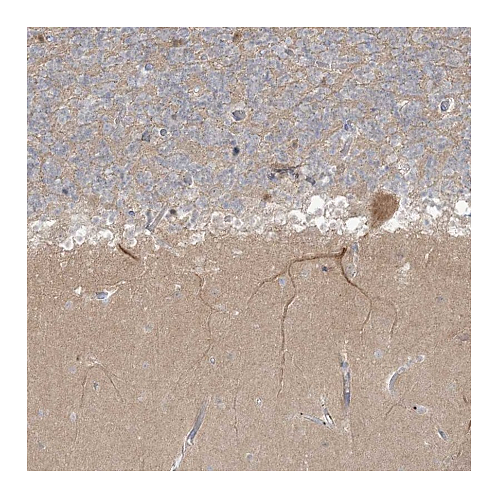 Atlas Antibodies Anti-TRIM2 Antibody