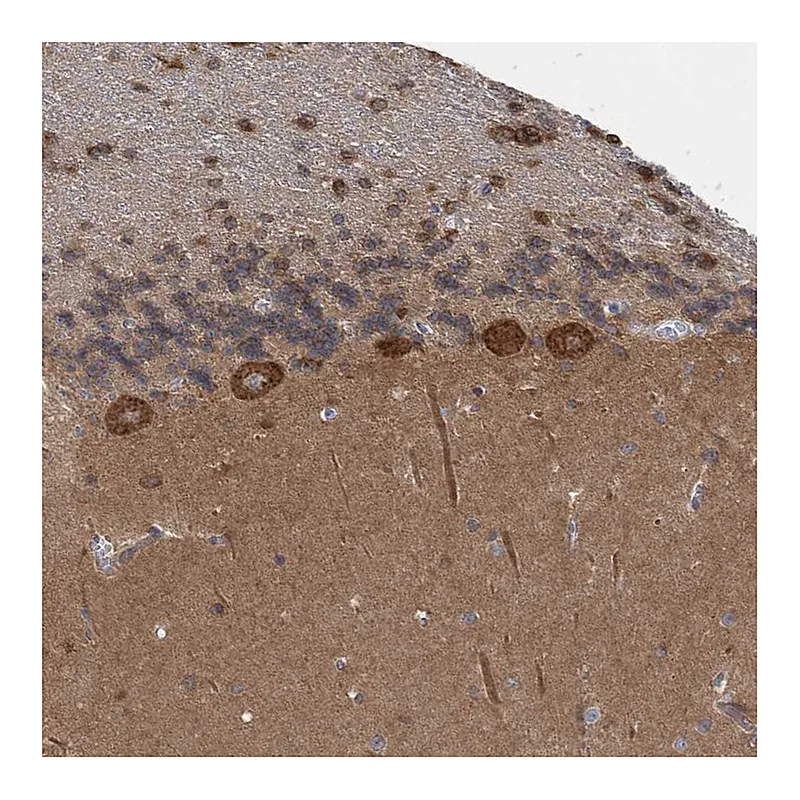 Atlas Antibodies Anti-TRIM2 Antibody