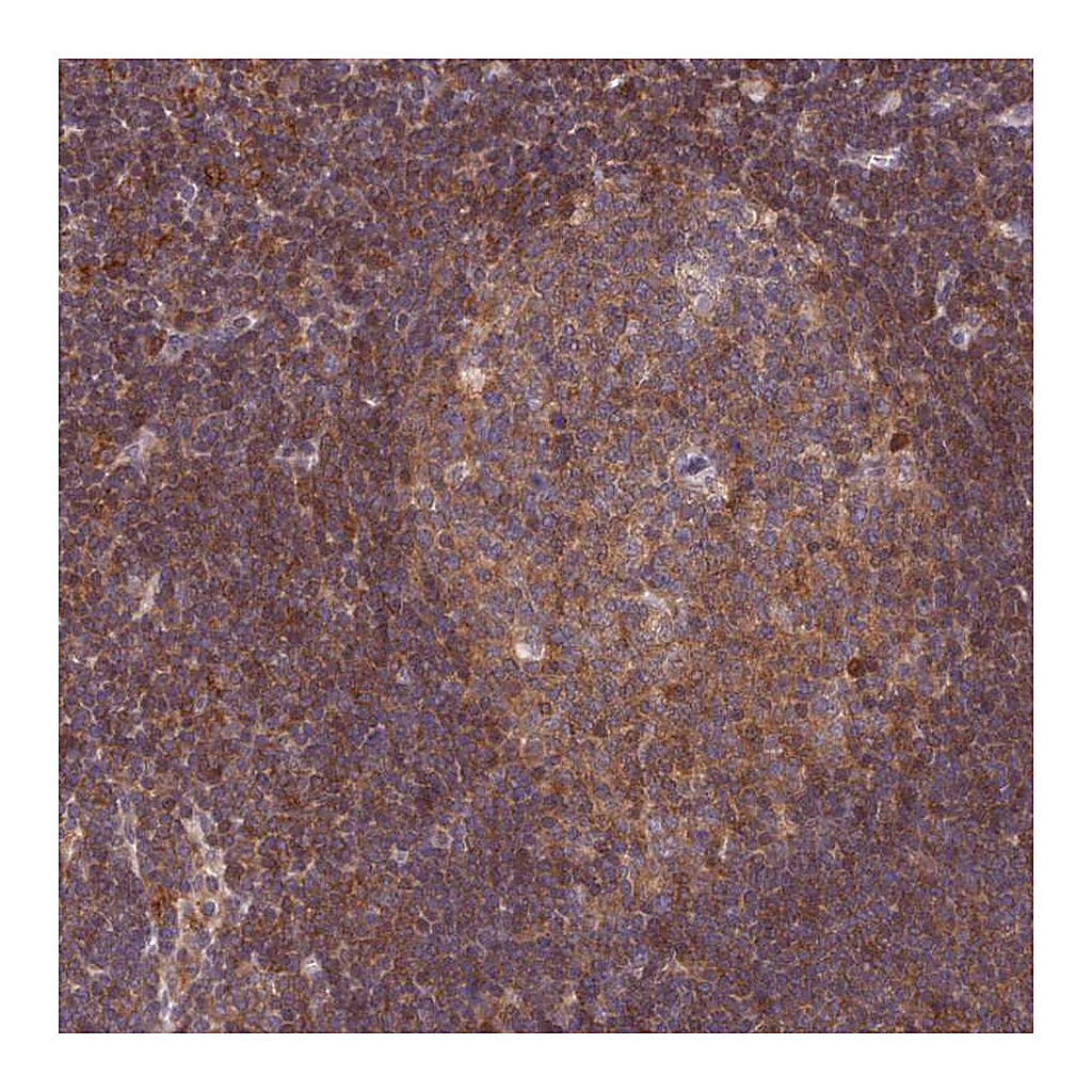 Atlas Antibodies Anti-TRIM26 Antibody