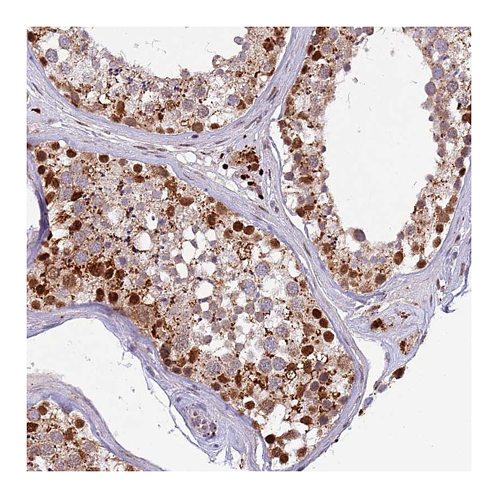 Atlas Antibodies Anti-TRIM27 Antibody