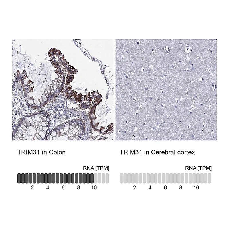 Atlas Antibodies Anti-TRIM31 Antibody