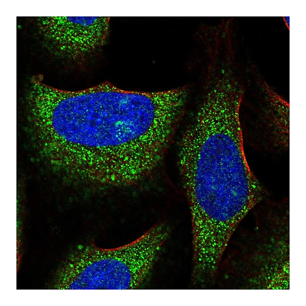 Atlas Antibodies Anti-TRIM39 Antibody