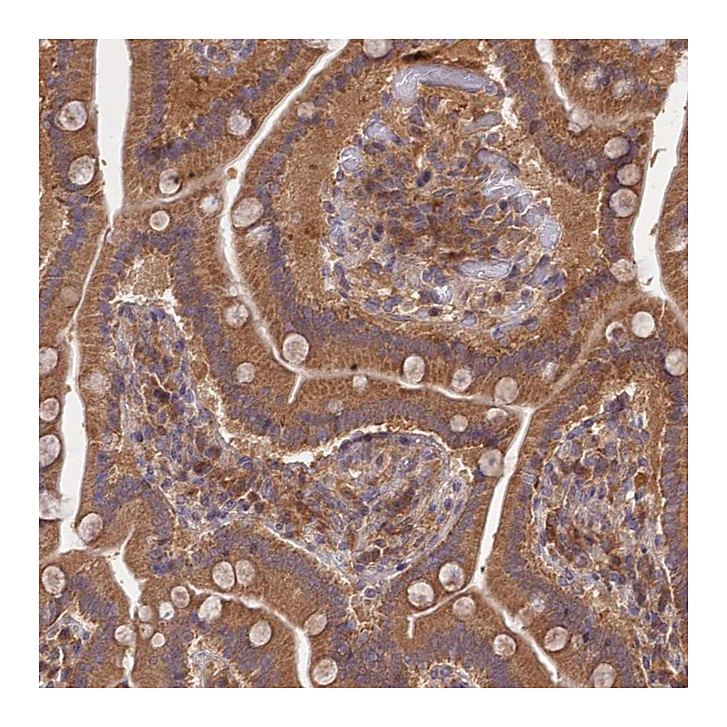 Atlas Antibodies Anti-TRIM40 Antibody