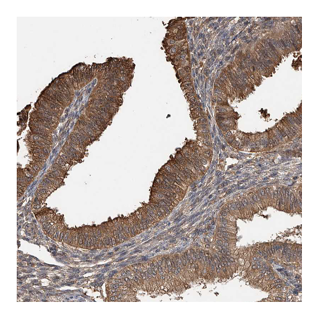Atlas Antibodies Anti-TRIM5 Antibody