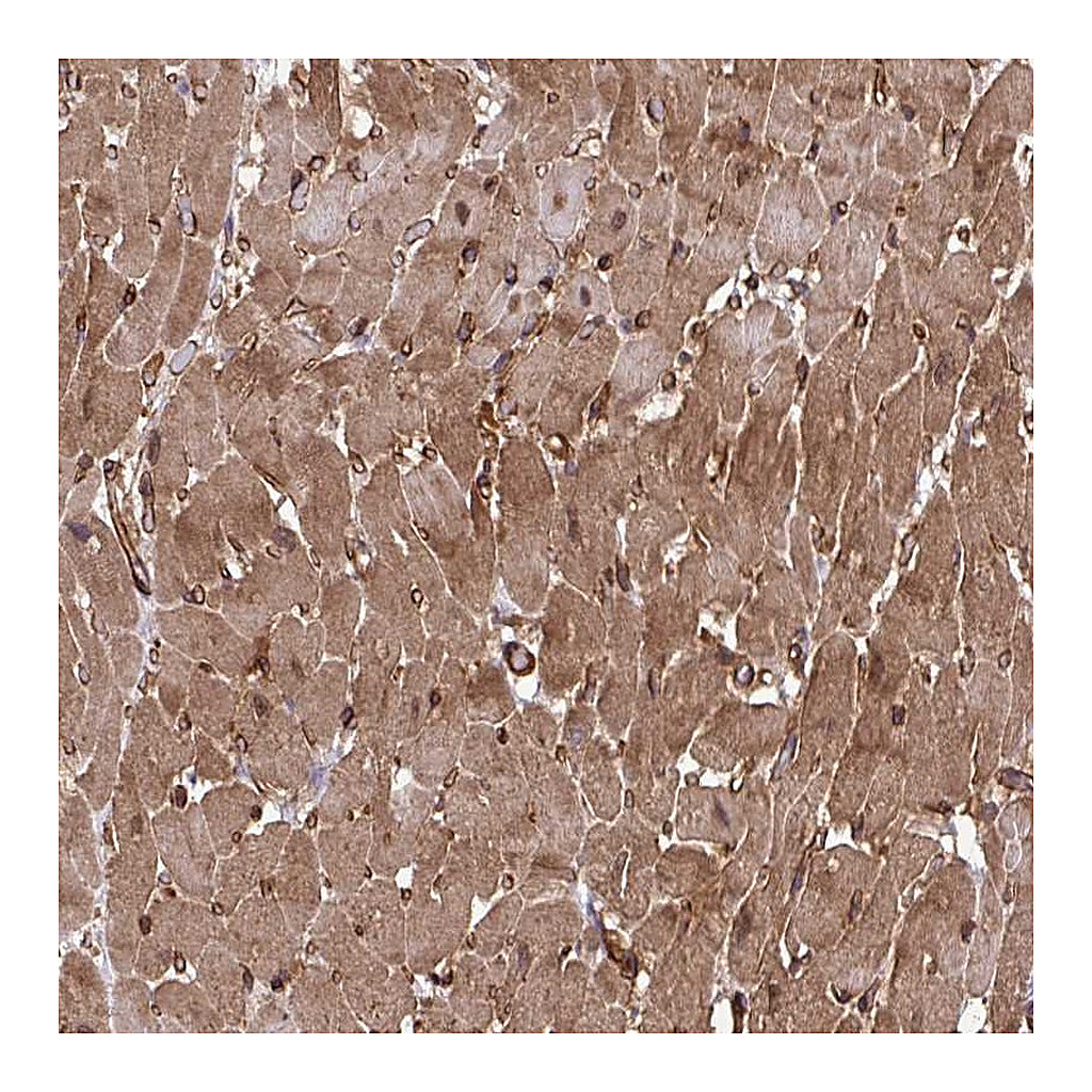 Atlas Antibodies Anti-TRIM52 Antibody