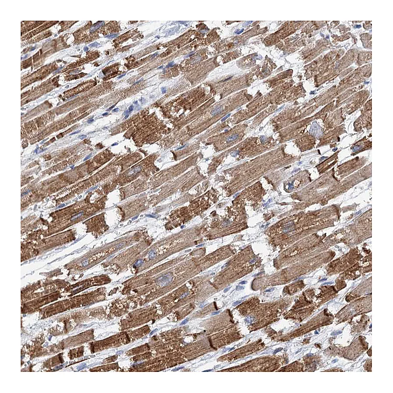 Atlas Antibodies Anti-TRIM55 Antibody