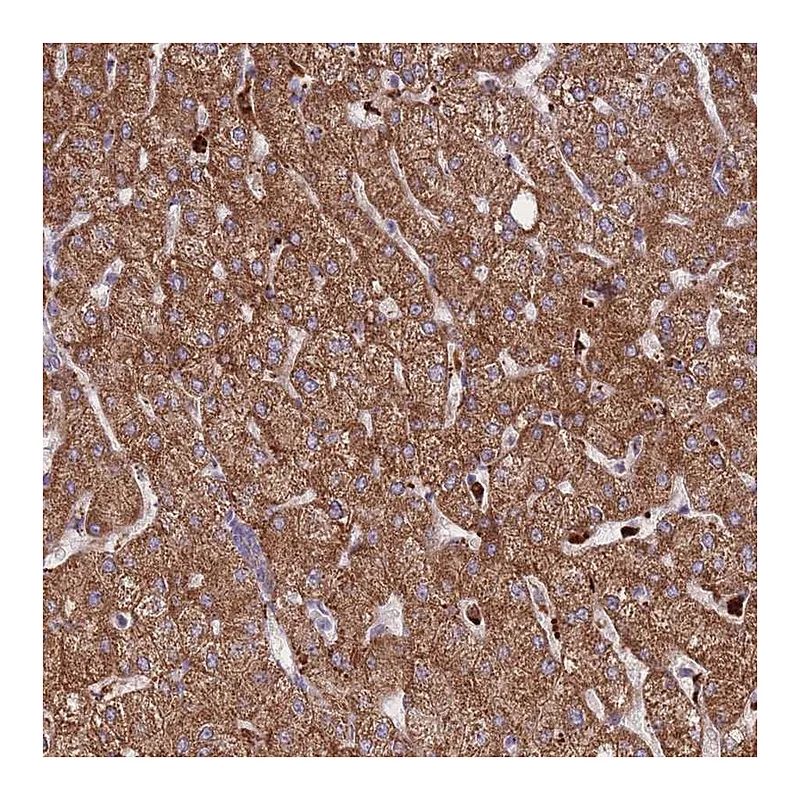 Atlas Antibodies Anti-TRIM61 Antibody