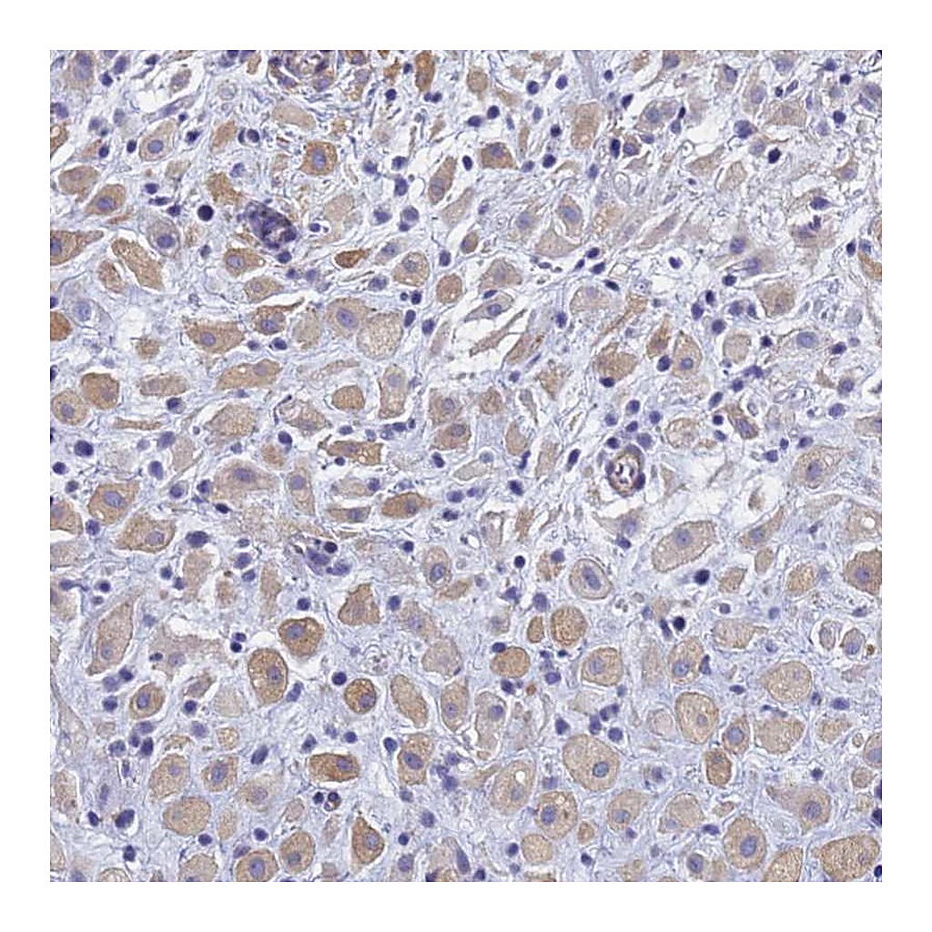 Atlas Antibodies Anti-TRIM64 Antibody
