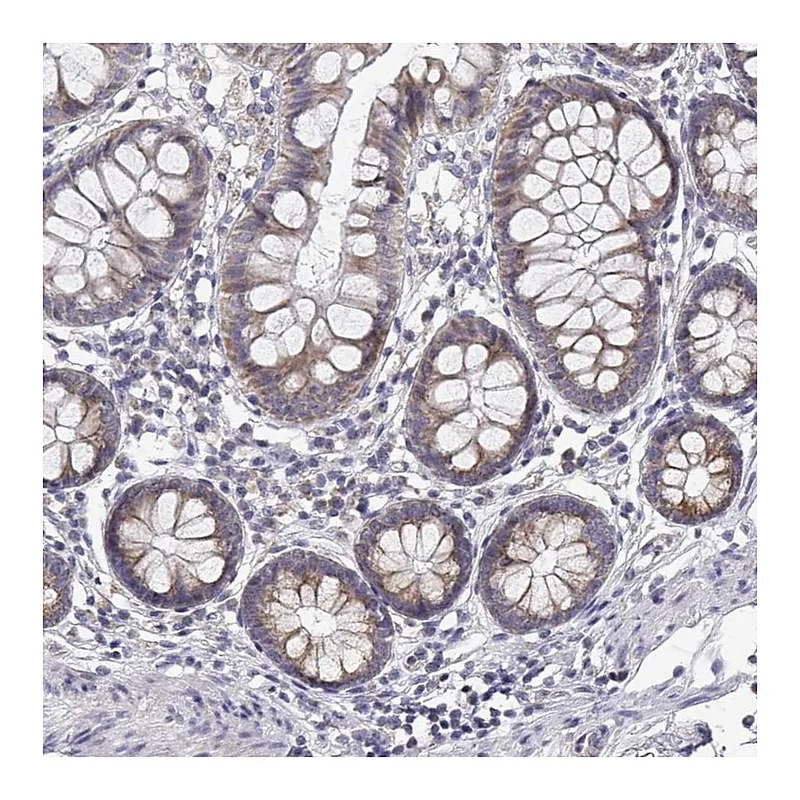 Atlas Antibodies Anti-TRIM60 Antibody