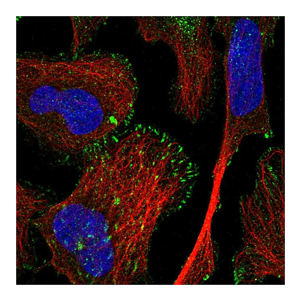 Atlas Antibodies Anti-TRIM62 Antibody