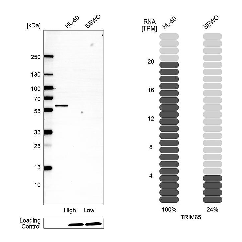 Atlas Antibodies Anti-TRIM65 Antibody