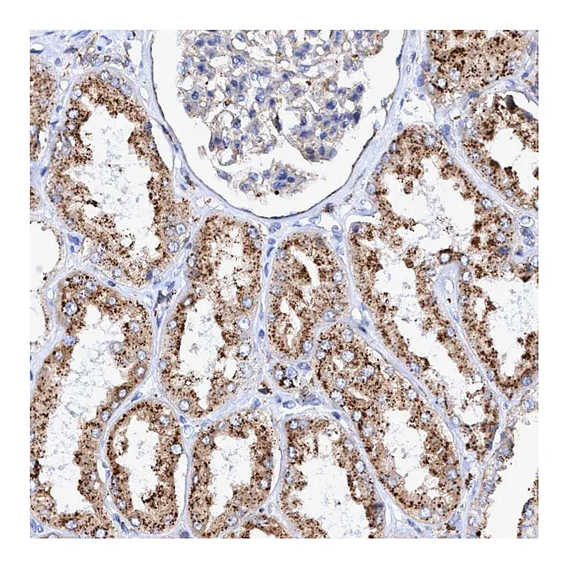 Atlas Antibodies Anti-TRIM65 Antibody