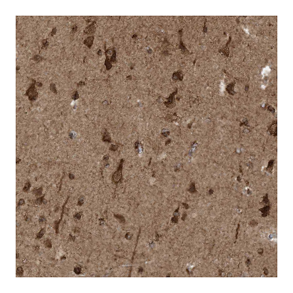 Atlas Antibodies Anti-TRIM67 Antibody
