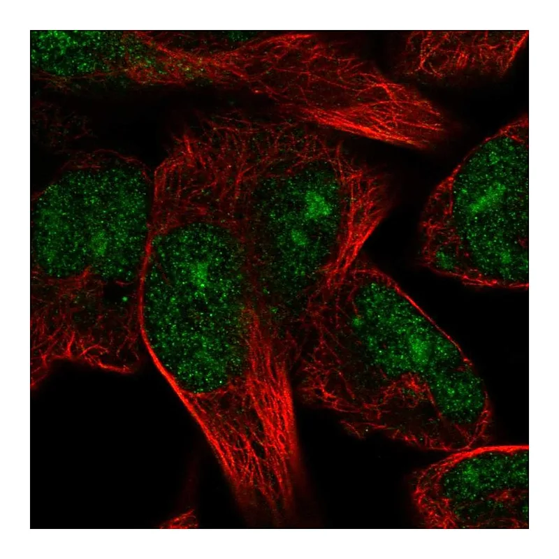 Atlas Antibodies Anti-TRIM72 Antibody