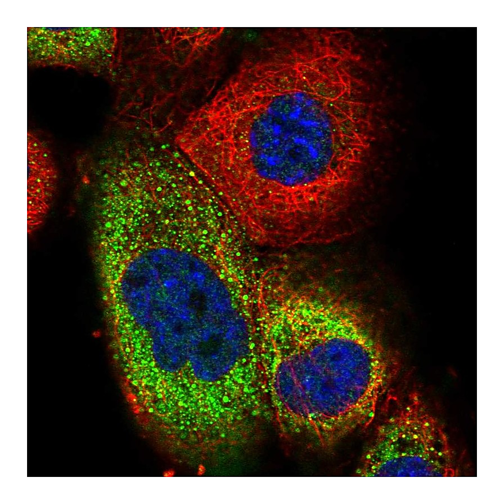Atlas Antibodies Anti-TRIM73 Antibody